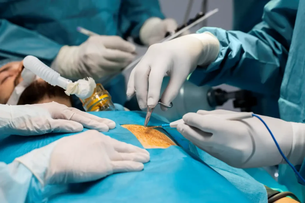 best laparoscopy surgeon in Indore
